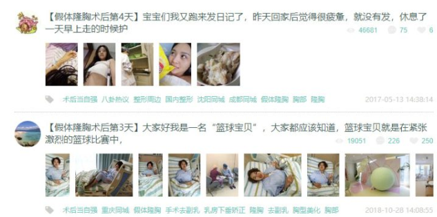 某整形網站的胸部美容整形福利話題-資源網站